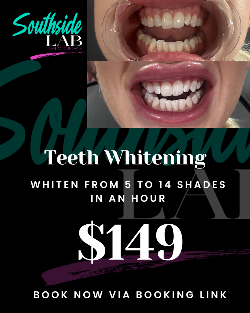 Teeth Whitening
